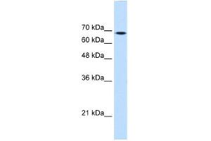 WB Suggested Anti-TGM2 Antibody Titration:  0. (Transglutaminase 2 Antikörper  (Middle Region))
