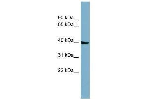 WB Suggested Anti-SLC35D3 Antibody Titration:  0.