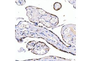 IHC analysis of LIN28B using anti-LIN28B antibody (ABIN7600743). (LIN28B Antikörper  (AA 23-249))