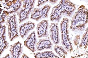 IHC analysis of PC4/SUB1 using anti-PC4/SUB1 antibody (ABIN7602184). (SUB1 Antikörper  (AA 62-127))