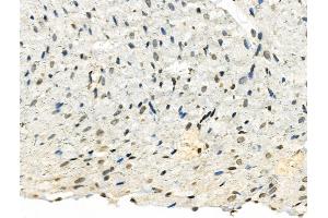 Phospho-TMS1/ASC (Ser195) Antibody at 1/100 staining Rat heart tissue by IHC-P. (PYCARD Antikörper  (pSer195))