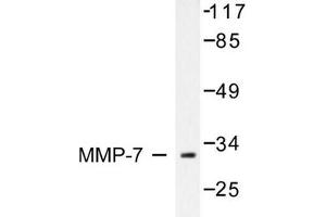 Image no. 1 for anti-Matrix Metallopeptidase 7 (Matrilysin, Uterine) (MMP7) antibody (ABIN265532) (MMP7 Antikörper)