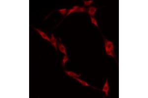 ABIN6274950 staining HepG2 by IF/ICC. (CLIP4 Antikörper  (Internal Region))