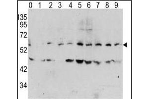 Western blot analysis of Phospho-MYC-T58 Antibody in human T activated Hela cell line lysates. (c-MYC Antikörper  (pThr58))