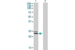 Western Blot analysis of NDUFV2 expression in transfected 293T cell line by NDUFV2 MaxPab polyclonal antibody. (NDUFV2 Antikörper  (AA 1-249))