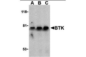 Western Blotting (WB) image for anti-Bruton Agammaglobulinemia tyrosine Kinase (BTK) (N-Term) antibody (ABIN1031284) (BTK Antikörper  (N-Term))