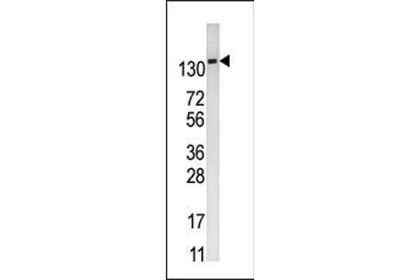 PFKFB2 Antikörper  (N-Term)