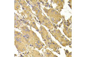 Immunohistochemistry of paraffin-embedded human stomach using PPP2CA antibody at dilution of 1:100 (x400 lens). (PPP2CA Antikörper)
