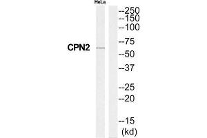 Western Blotting (WB) image for anti-Carboxypeptidase N Subunit 2 (CPN2) (C-Term) antibody (ABIN1851028) (CPN2 Antikörper  (C-Term))