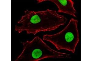 Fluorescent image of HeLa cells stained with SUMO-2 antibody at 1:25 dilution. (SUMO2 Antikörper)