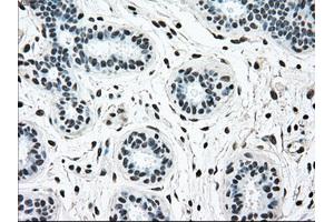 Immunohistochemical staining of paraffin-embedded breast tissue using anti-BRAF mouse monoclonal antibody. (BRAF Antikörper)