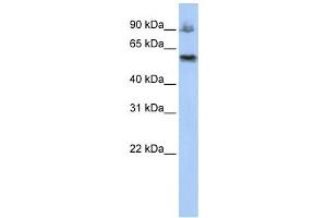 Western Blotting (WB) image for anti-Activating Signal Cointegrator 1 Complex Subunit 2 (ASCC2) antibody (ABIN2458679)