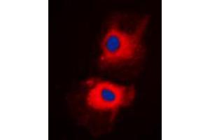 Immunofluorescent analysis of HGS staining in H1299 cells. (HGS Antikörper  (Center))