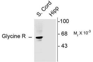 Image no. 1 for anti-Glycine Receptor, alpha 1 (GLRA1) (N-Term) antibody (ABIN372657) (GLRA1 Antikörper  (N-Term))