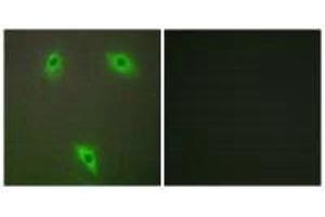Immunofluorescence analysis of A549 cells, using KLHL3 antibody. (KLHL3 Antikörper  (N-Term))