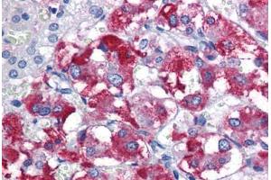 Human Adrenal: Formalin-Fixed, Paraffin-Embedded (FFPE)