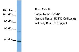 Host: Rabbit Target Name: KANK1 Sample Type: HCT15 Whole Cell lysates Antibody Dilution: 1. (ANKRD15 Antikörper  (C-Term))