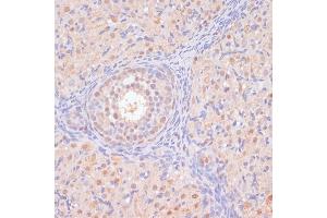 Immunohistochemistry of paraffin-embedded rat ovary using BYSL antibody (ABIN6129546, ABIN6137672, ABIN6137674 and ABIN6215553) at dilution of 1:100 (40x lens). (Bystin-Like Antikörper  (AA 120-280))