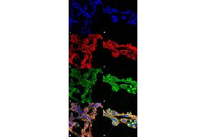 Immunocytochemistry/Immunofluorescence analysis using Mouse Anti-7-Ketocholesterol Monoclonal Antibody, Clone 7E1 . (7-Ketocholesterol (7-KC) Antikörper (APC))