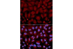 Immunofluorescence analysis of U2OS cell using BCHE antibody. (Butyrylcholinesterase Antikörper  (AA 29-270))