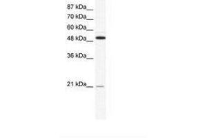Image no. 1 for anti-Tumor Necrosis Factor Receptor Superfamily, Member 11b (TNFRSF11B) (N-Term) antibody (ABIN202431) (Osteoprotegerin Antikörper  (N-Term))