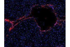 Immunofluorescence (IF) image for anti-Platelet/endothelial Cell Adhesion Molecule (PECAM1) antibody (Alexa Fluor 594) (ABIN2656826) (CD31 Antikörper  (Alexa Fluor 594))