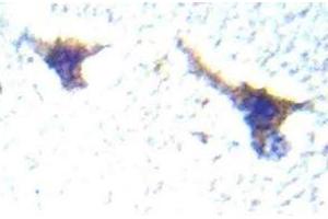 Immunohistochemistry (IHC) analyzes of PKD1/PKC-mu antibody in paraffin-embedded human brain tissue. (PKC mu Antikörper)