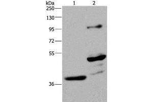 Western Blot analysis of Human fetal brain and Mouse brain tissue using GAS7 Polyclonal Antibody at dilution of 1:625 (GAS7 Antikörper)