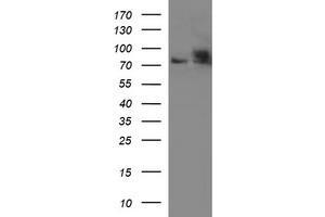 Western Blotting (WB) image for anti-Hydroxysteroid (17-Beta) Dehydrogenase 4 (HSD17B4) antibody (ABIN2715563)