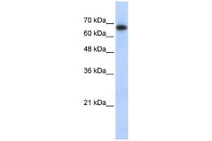 WB Suggested Anti-ZSCAN12 Antibody Titration:  0. (ZSCAN12 Antikörper  (Middle Region))