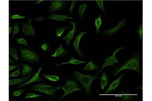 Immunofluorescence (IF) image for anti-phosphorylase Kinase, gamma 2 (Testis) (PHKG2) (AA 1-406) antibody (ABIN518865)