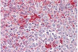 Anti-TLR5 antibody IHC staining of human spleen. (TLR5 Antikörper  (AA 300-350))