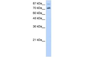 WB Suggested Anti-CDC25B Antibody Titration:  0.