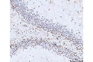 IHC analysis of HnRNP H/HNRNPH1 using anti-HnRNP H/HNRNPH1 antibody (ABIN4886623).