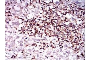 Immunohistochemistry (IHC) image for anti-CD68 Molecule (CD68) (AA 42-155) antibody (ABIN2682982)