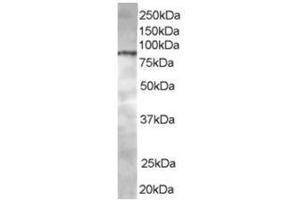 Image no. 1 for anti-ArfGAP with Coiled-Coil, Ankyrin Repeat and PH Domains 1 (ACAP1) (C-Term) antibody (ABIN374366) (ACAP1 Antikörper  (C-Term))