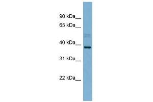 Western Blotting (WB) image for anti-Membrane-Associated Ring Finger (C3HC4) 8, E3 Ubiquitin Protein Ligase (MARCH8) (N-Term) antibody (ABIN2775651)