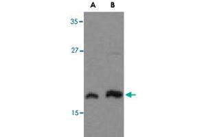 Western blot analysis of MLST8 in human brain tissue lysate with MLST8 polyclonal antibody  at (A) 1 and (B) 2 ug/mL . (GBL Antikörper  (C-Term))