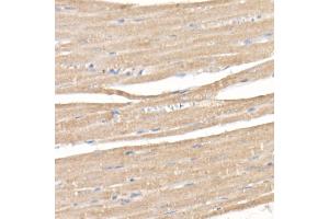 Immunohistochemistry of paraffin-embedded rat heart using SARA Rabbit mAb (ABIN7271559) at dilution of 1:50 (40x lens). (ZFYVE9 Antikörper)