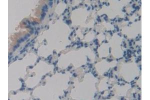 Immunohistochemistry (IHC) image for anti-phospholipase A2 Receptor 1, 180kDa (PLA2R1) (AA 1418-1487) antibody (ABIN7443389)