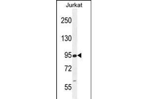RSBN1 Antibody (N-term) (ABIN655484 and ABIN2845005) western blot analysis in Jurkat cell line lysates (35 μg/lane). (RSBN1 Antikörper  (N-Term))