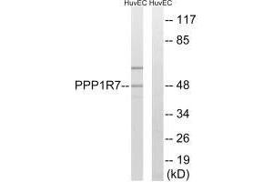 Western blot analysis of extracts from HUVEC cells, using PPP1R7 antibody. (PPP1R7 Antikörper)