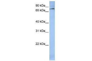 ALOX12 antibody used at 1 ug/ml to detect target protein. (ALOX12 Antikörper  (C-Term))