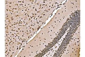 IHC analysis of SPHK1 using anti-SPHK1 antibody (ABIN7600168). (SPHK1 Antikörper  (AA 16-267))