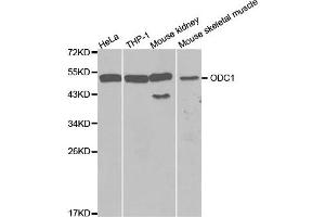 Western Blotting (WB) image for anti-Ornithine Decarboxylase 1 (ODC1) antibody (ABIN1873996) (ODC1 Antikörper)