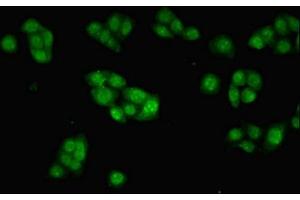 Immunofluorescent analysis of PC-3 cells using ABIN7156239 at dilution of 1:100 and Alexa Fluor 488-congugated AffiniPure Goat Anti-Rabbit IgG(H+L) (INHBB Antikörper  (AA 295-405))