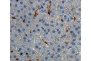 Used in DAB staining on fromalin fixed paraffin-embedded liver tissue (IGF1 Antikörper  (AA 33-102))