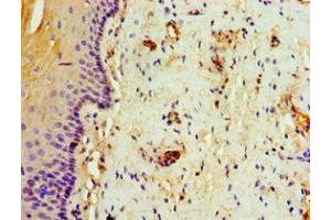 Immunohistochemistry (IHC) image for anti-Transporter 1, ATP-Binding Cassette, Sub-Family B (MDR/TAP) (TAP1) (AA 524-808) antibody (ABIN7144328)