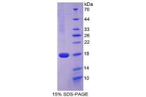 SDS-PAGE (SDS) image for CD99 (CD99) (AA 26-160) protein (His tag) (ABIN1980937) (CD99 Protein (CD99) (AA 26-160) (His tag))