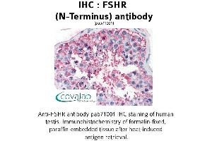 Image no. 1 for anti-Follicle Stimulating Hormone Receptor (FSHR) (Extracellular Domain), (N-Term) antibody (ABIN1734473) (FSHR Antikörper  (Extracellular Domain, N-Term))